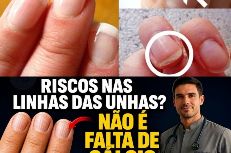 LINHAS VERTICAIS NAS UNHAS: O ALERTA QUE SEU CORPO ENVIA E NINGUÉM TE CONTOU