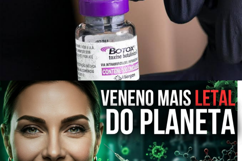 O VENENO MAIS LETAL DO PLANETA está no seu rosto: Como a toxina do “Salsichão da Morte” virou a obsessão bilionária das clínicas de estética